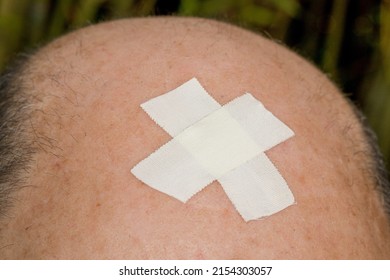 Adhesive patch on forehead of bald aging man, closeup