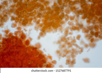 Adipose Tissue Under The Microscope View Show Contains Large Lipid Droplet.