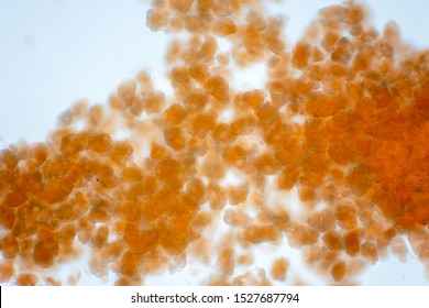 Adipose Tissue Under The Microscope View Show Contains Large Lipid Droplet.