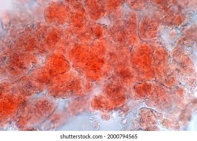 Adipose Tissue Under The Microscope View Show Contains Large Lipid Droplet.