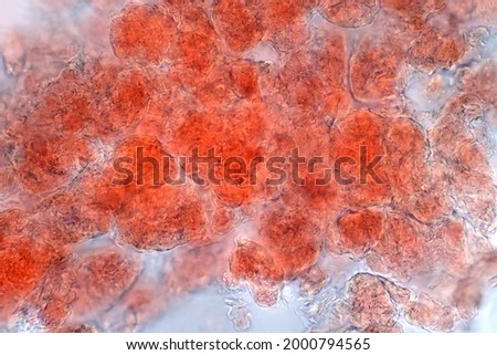 Adipose tissue under the microscope view show contains large lipid droplet.
