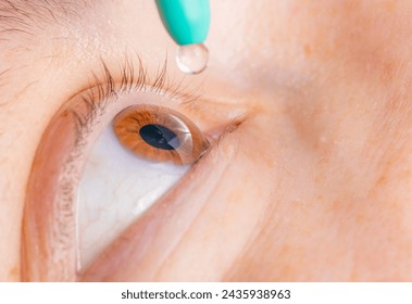 Administering glaucoma eye drops for ocular health
