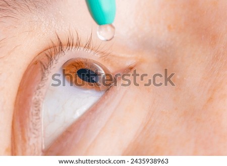 Administering glaucoma eye drops for ocular health Foto d'archivio © 