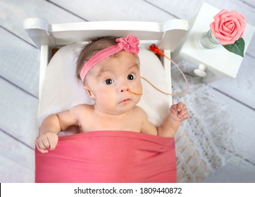 Adorable Awake Infant Girl With Trisomy 18 NG Tube In A Tiny Bed