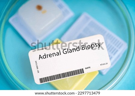 Adrenal gland biopsy. A small piece of adrenal gland tissue to evaluate for conditions such as adrenal tumors or hyperplasia.