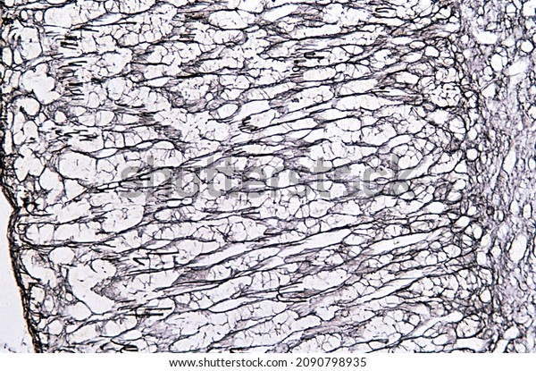 \
Adrenal gland. Silver method for reticular\
fibers. The image shows an adrenal cortex in which the glomerular,\
fasciculate and reticular zones are distinguished. The medulla is\
on right  border
