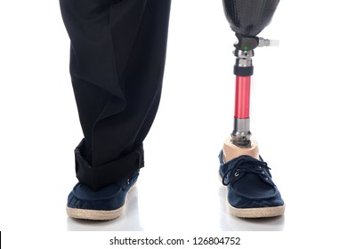 An adult man with a below knee amputation stands upright with his new prosthetic leg.
