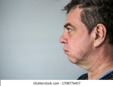 Adult Man With Double Chin Face Profile