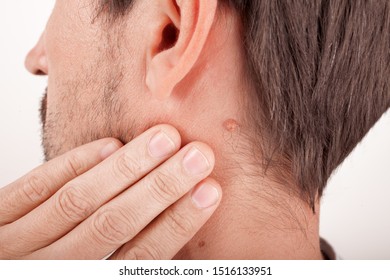 390px x 280px - Removal Moles Neck Images, Stock Photos & Vectors | Shutterstock