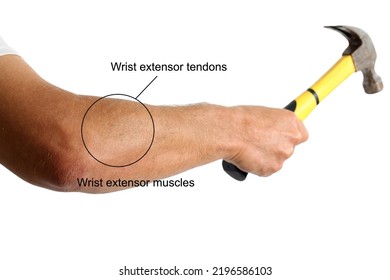 Adult Man's Arm Holding Hammer Isolated On White, Showing Area Of Pain And Symptoms Of Injured. Overuse Injuries Of The Elbow Due To  The Repetitive Nature Or Work And Sporting Activities.