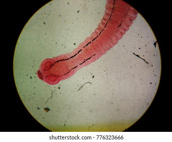Adult of Taenia Spp.