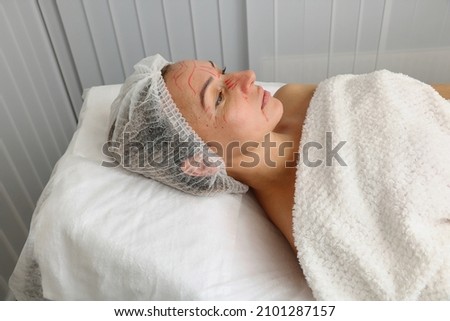Adult woman in beauty salon with red marks on face