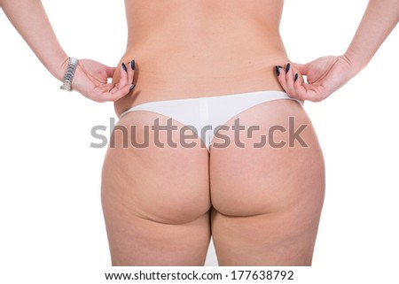 Adult woman; pinching skin on the waist