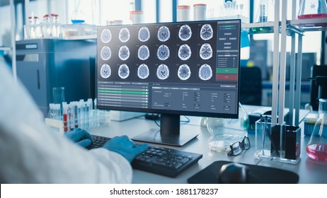 Advanced Brain Research Laboratory: Neurology Scientist is Using Personal Computer Showing MRI, CT Scans with Brain Images. Modern Laboratory Working on Brain Research, Developing Vaccine, Drugs.