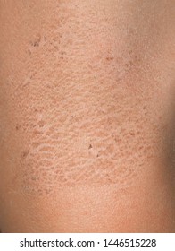 Skin Texture Images, Stock Photos & Vectors | Shutterstock