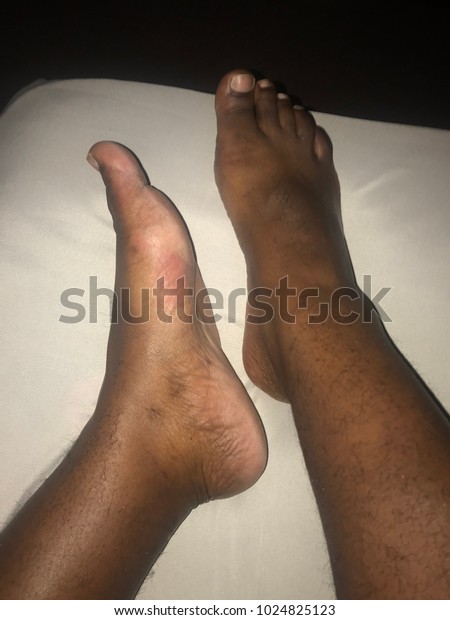 Sexy Bbw Feet