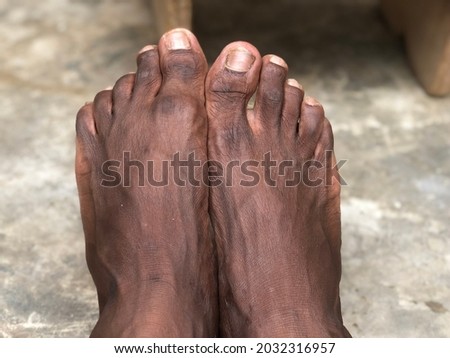 African beautiful barefeet display in one summer day.