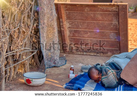 african child toddler sick with malaria medicine in the background, laying down on a blanket in the yard