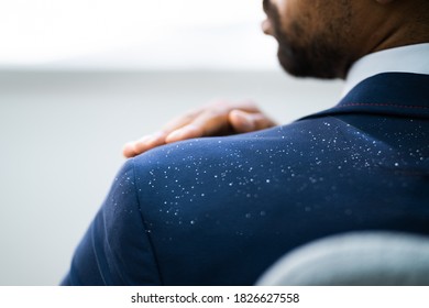 African Man Brushing Dandruff From Dirty Suit