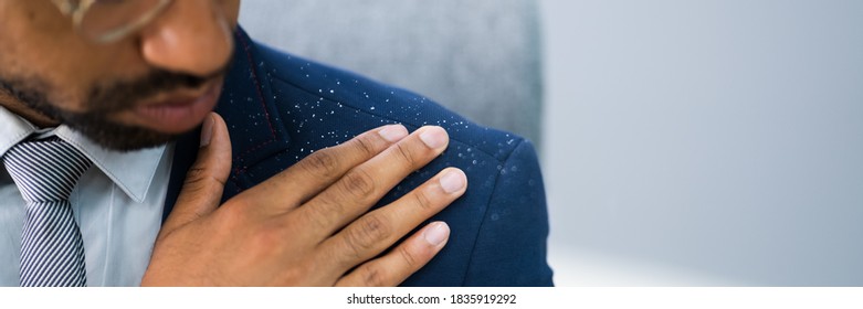 African Man Brushing Dandruff From Dirty Suit