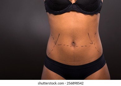 African Woman Body Marked For Plastic Surgery On Black Background