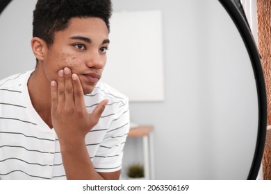 African-American teenage boy with acne problem at home