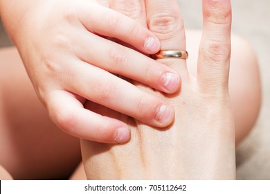 After Effects Of Coxsackie Virus: Onychomadesis (nail Shedding) In A 3-year-old Child, 1 Month After The Hand, Foot And Mouth Disease With Coxsackie Viral Infection