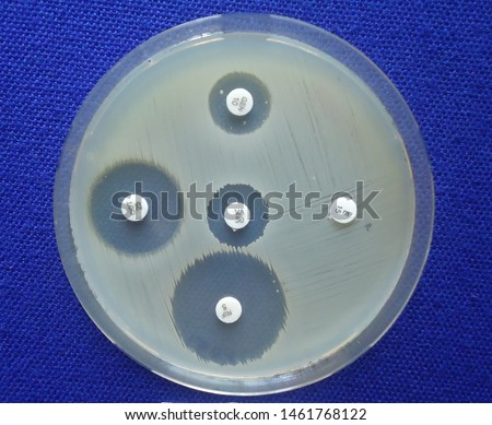 Agar Disc Diffusion Test for antibiotic screening. It is also called Kirby Bauer Disc Diffusion Test.