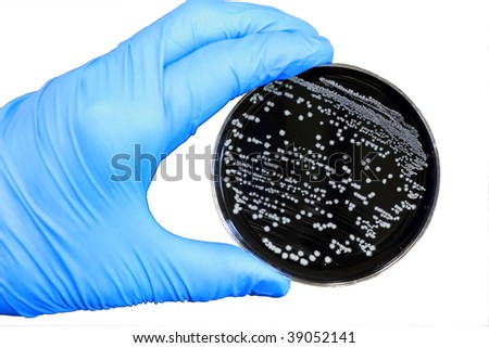 An agar plate being examined for Campylobacter.
