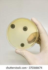 Agar plate full ofmicro bacterias and microorganisms - Shutterstock ID 370368674