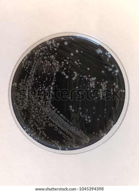 Agar plate of Legionella pneumophila\
(Legionnaire\'s disease)