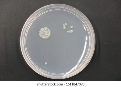 Agar Plate On Black Lab Table With E. Coli (Escherichia Coli) Colonies Forming On Agar