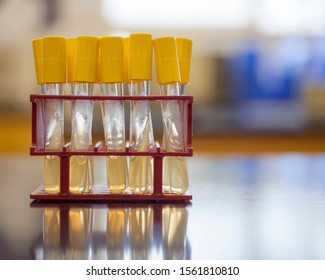 Agar Slant For Growing Microorganisms.