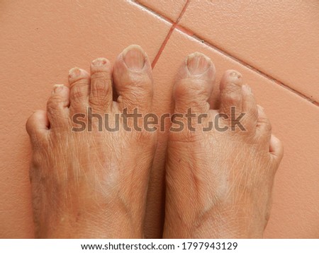 aged woman toe closeup capture