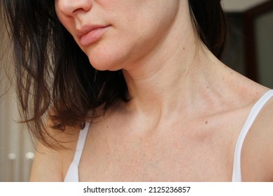 Age-related Changes In The Face, Neck And Décolleté, Age Spots, Wrinkles, Skin Aging