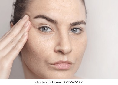 Age-related changes on the face of a middle-aged woman. First wrinkles. A woman thinks about a facelift, plastic surgery. Cropped close up