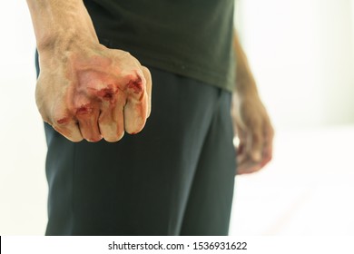 Aggressive violent man in a fight, with a bloody fist.