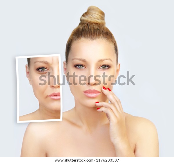 Aging. Mature woman-young woman.Face
with skin problem.Showing photos before and
after