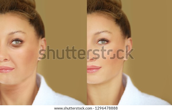Aging.\
Mature woman-young woman.Face with skin\
problem