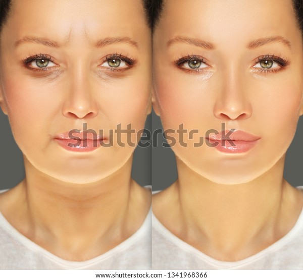Aging.
Mature woman-young woman.Face with skin
problem