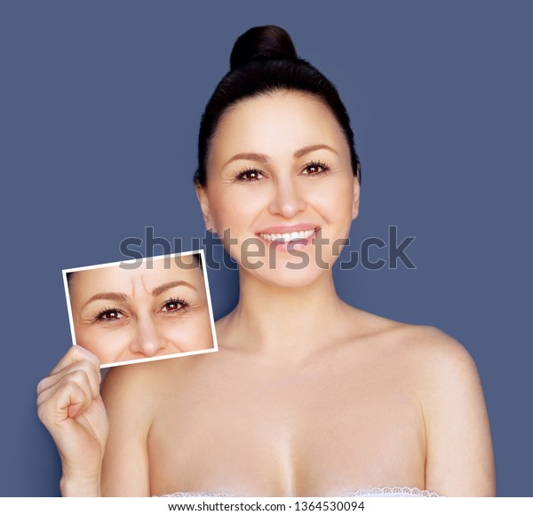 Aging. Mature woman-young woman.Face\
with skin problem.Showing photos before and\
after