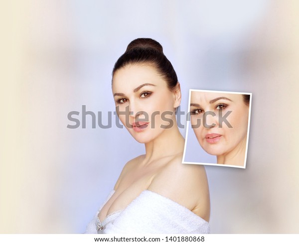 Aging. Mature woman-young woman.Face\
with skin problem.Showing photos before and\
after