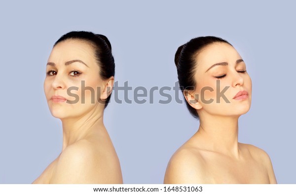 Aging. Mature woman-young woman.Face\
with skin problem.Showing photos before and\
after	