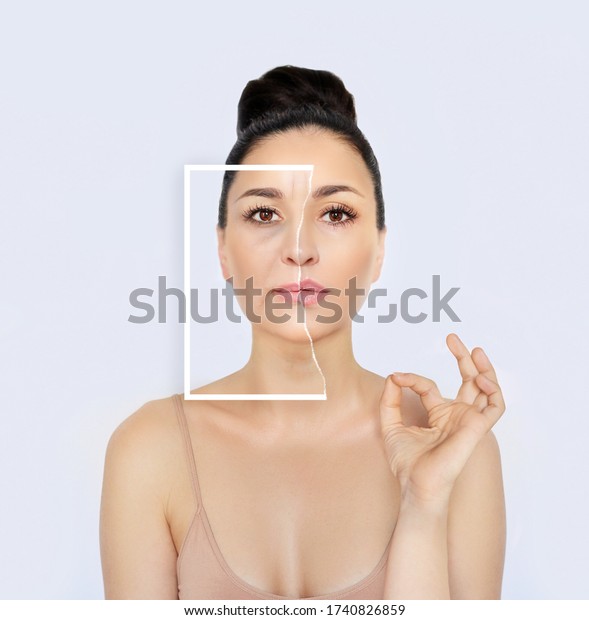 Aging. Mature woman-young woman.Face\
with skin problem.Showing photos before and\
after	\
