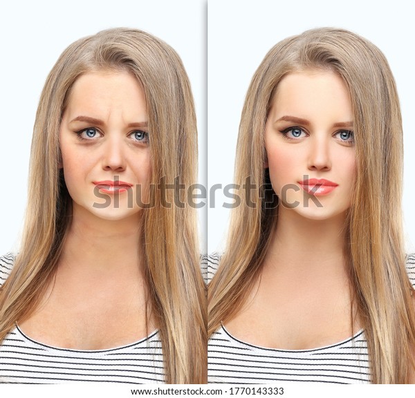 Aging. Mature woman-young woman.Face\
with skin problem.Showing photos before and\
after	