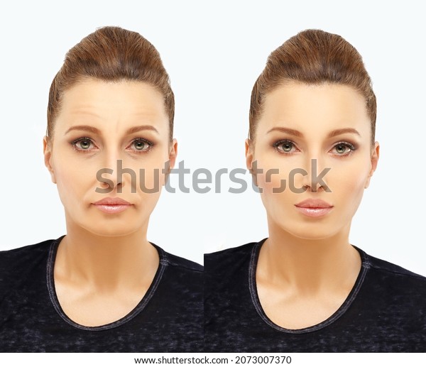 Aging. Mature woman-young woman.Face\
with skin problem.Before and after cosmetic\
procedures