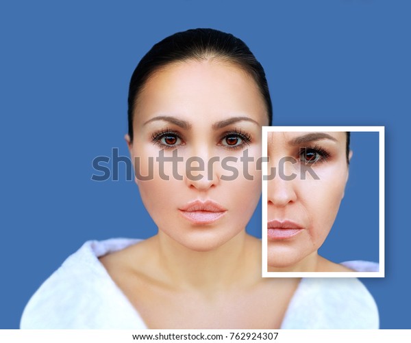 Aging.\
Mature woman-young woman.Face with skin\
problem