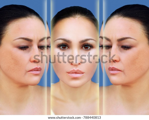 Aging.
Mature woman-young woman.Face with skin
problem