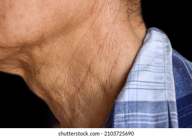 Aging skin folds, creases or wrinkles at neck of Southeast Asian, Chinese old man.