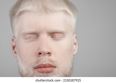 Albinism, abnormal deviations concept. Unusual bearded albino man posing with closed eyes, guy with unusual appearance, white hair, eyelashes and brows against grey studio background, copy space